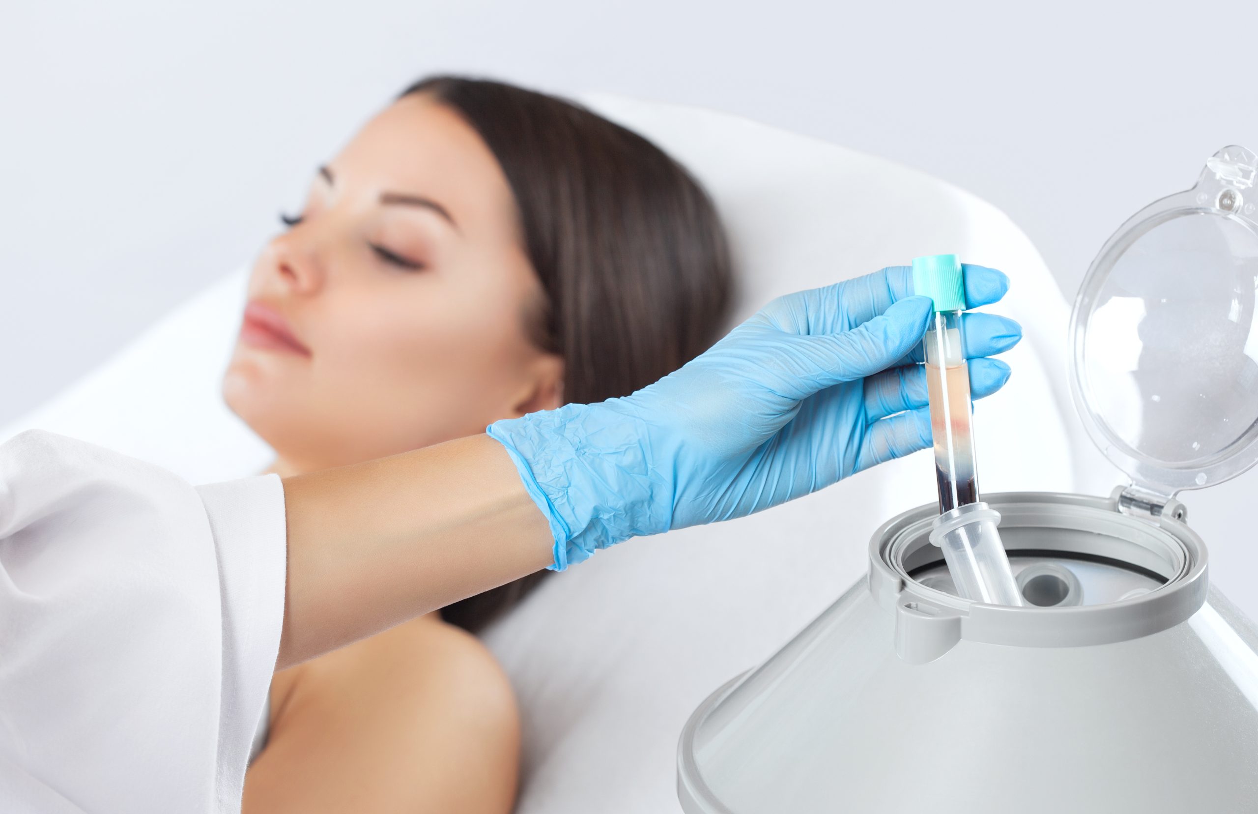 Vampire Facial Training & PRP